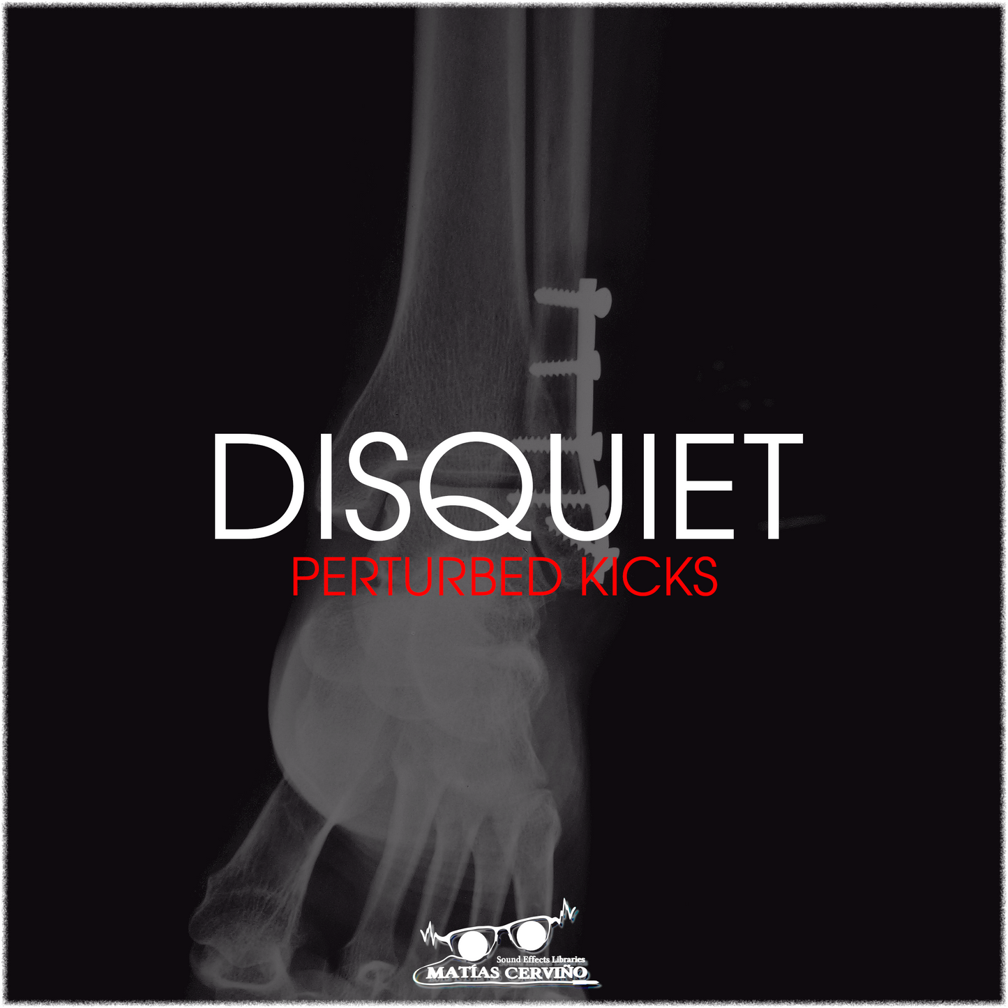 Disquiet